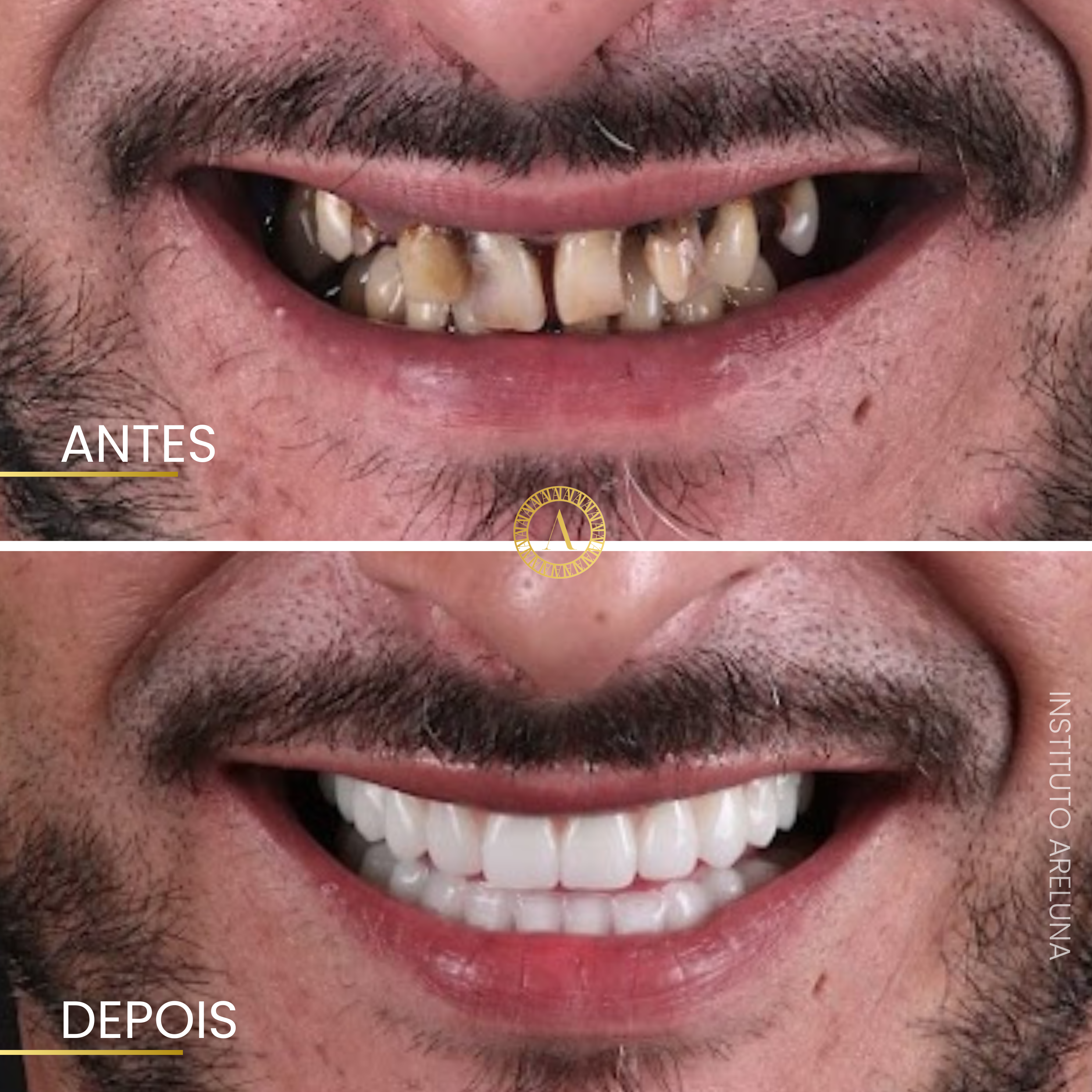 Transformação Completa - Antes e Depois