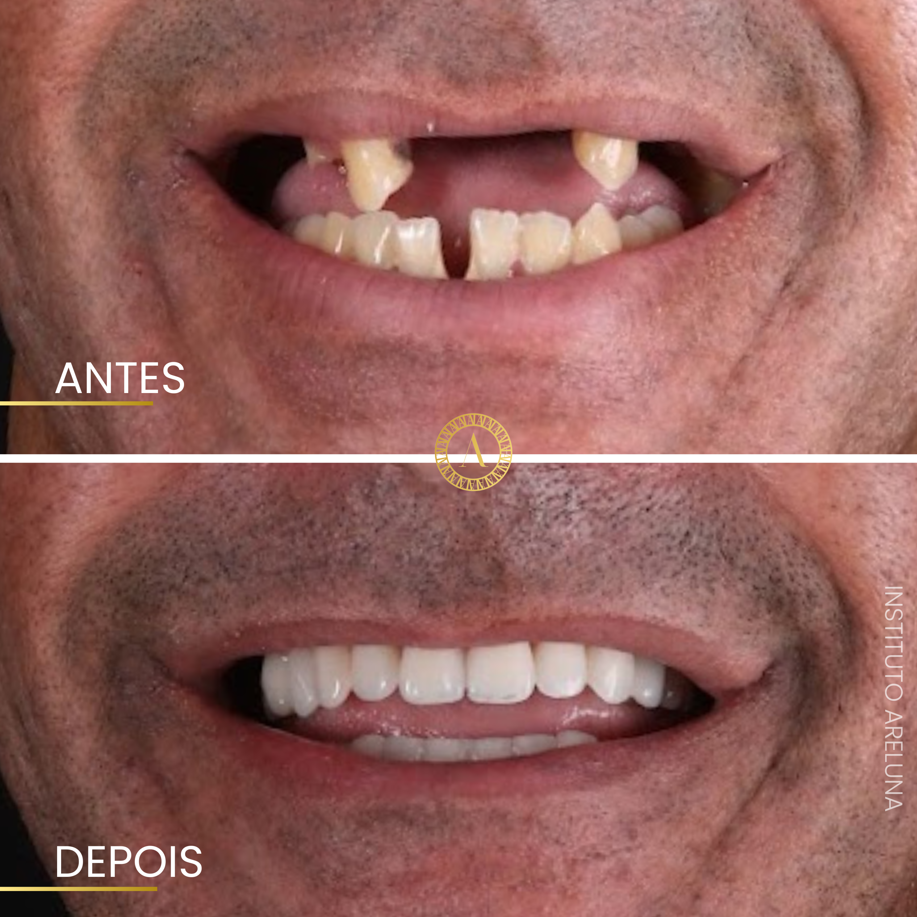 Sorriso Renovado - Antes e Depois