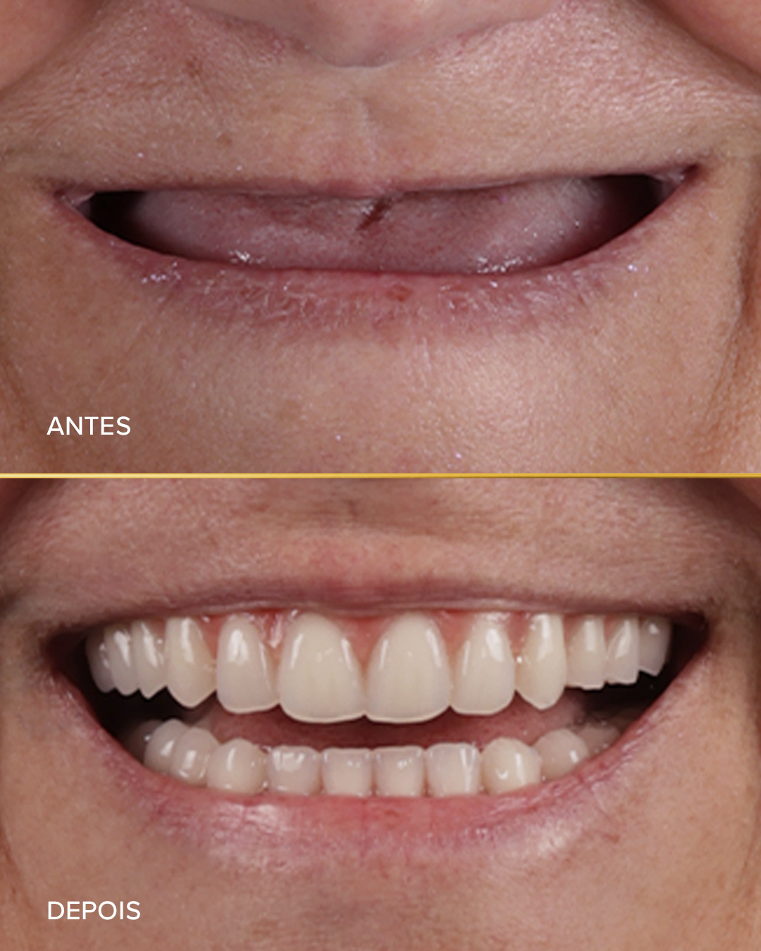 Mudança de Vida - Antes e Depois